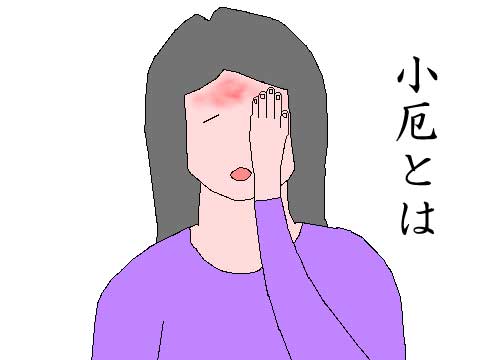 小厄のイラスト